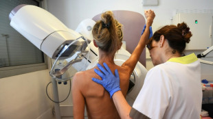 Les mammographies recommandées dès 40 ans aux Etats-Unis