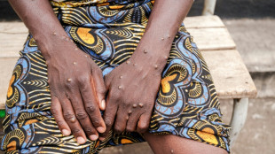 Primer caso de mpox en Marruecos y en el norte de África