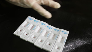 Oms, met&agrave; delle diagnosi di Hiv in Europa arriva troppo tardi