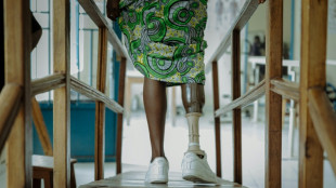 DR Congo's amputees bear scars of years of conflict