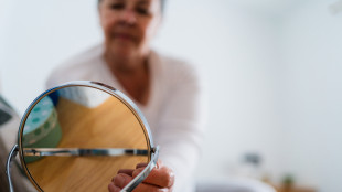 Acromegalia,malattia subdola si confonde con normali segni tempo