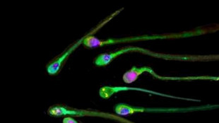 Il Covid altera lo sperma e aumenta l'ansia nella prole